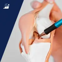 Ein Arzt zeigt mit einem Kugelschreiber auf das Kreuzband des Knies